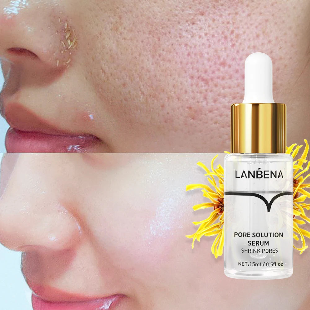 LANBENA Pore Solution Serum Shrink Pores Acne Treatment Remover Nose Blackhead Skin Firming Moisturizing Face Serum Skin Care