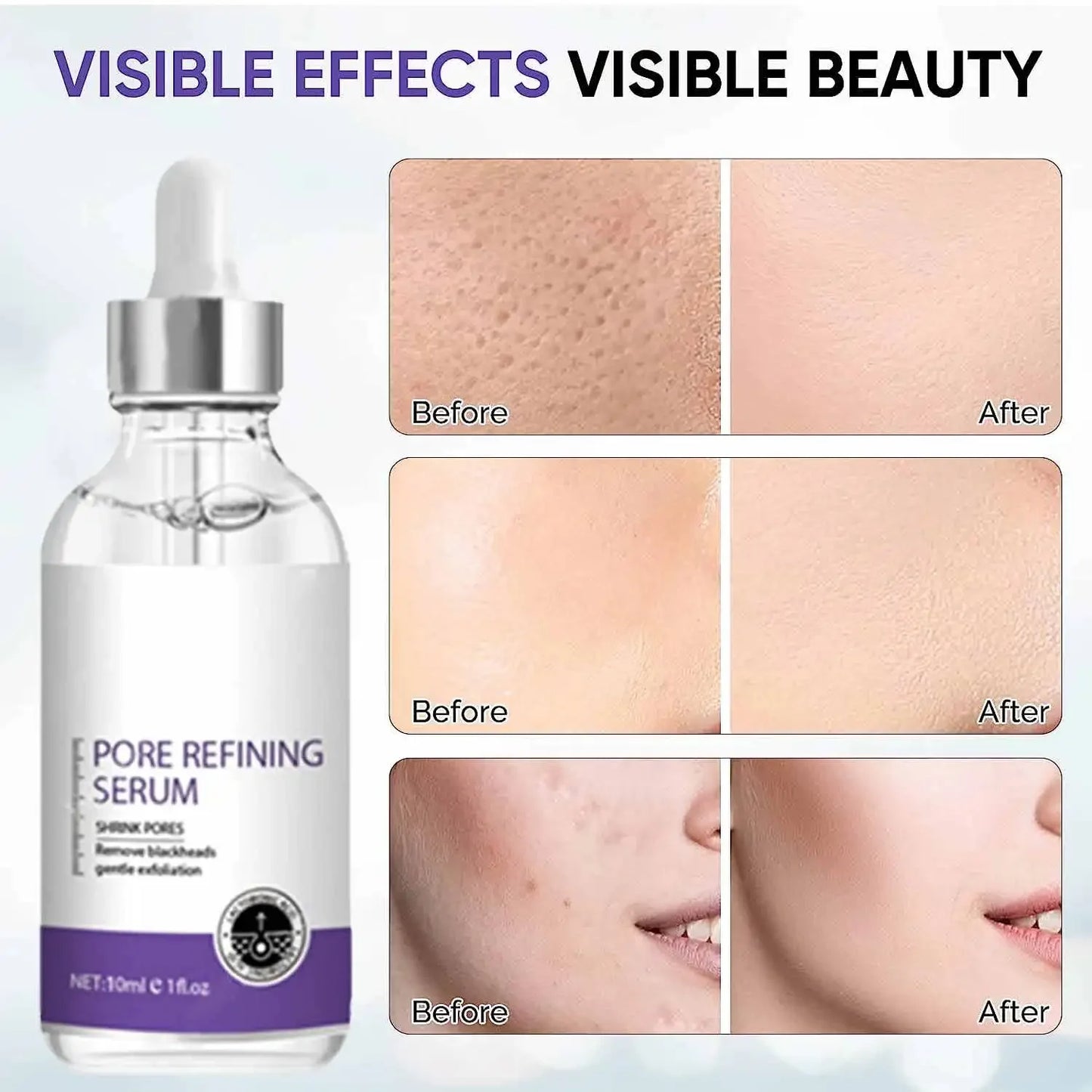 Pore Shrinking Serum Face Removing Large Pores Tightening Repairing Facial Pore Minimizing Essence Skin Care Beauty Firm skin